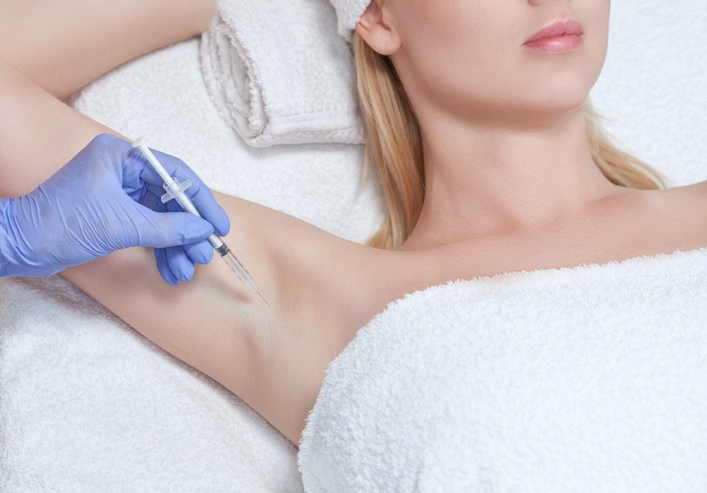 Does Botox for Excessive Sweating Really Work? woman getting botox in her underarms