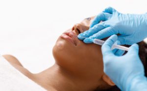 woman getting a lip flip procedure with botox in los angeles on a white background, closeup