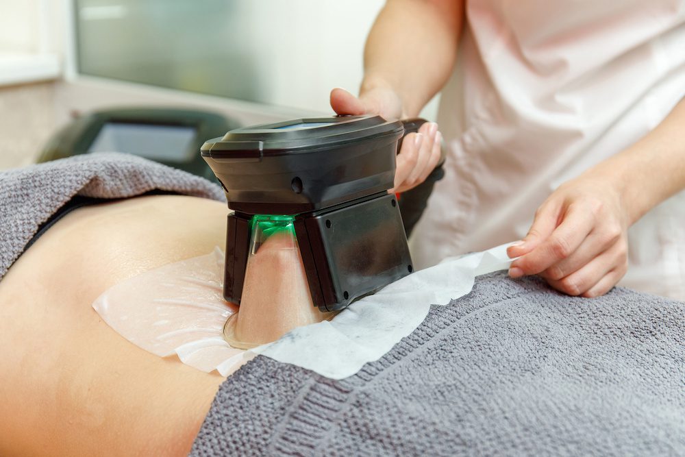 Should You Postpone Your CoolSculpting Appointment Until After Losing Weight woman getting coolsculpting done in los angeles after losing weight