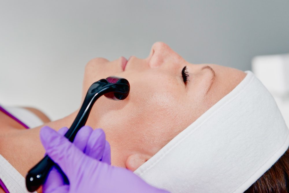 The Health Benefits of Microneedling woman getting microneedling done in los angeles